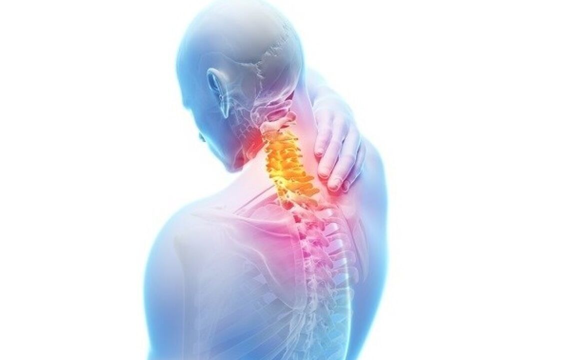 neck pain with osteonecrosis