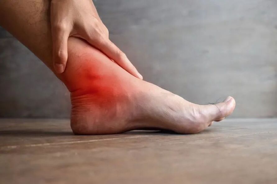 ankle arthritis