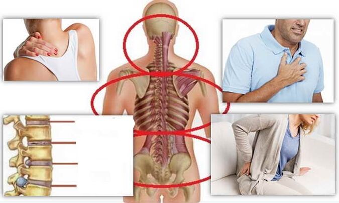 infected place in bone necrosis